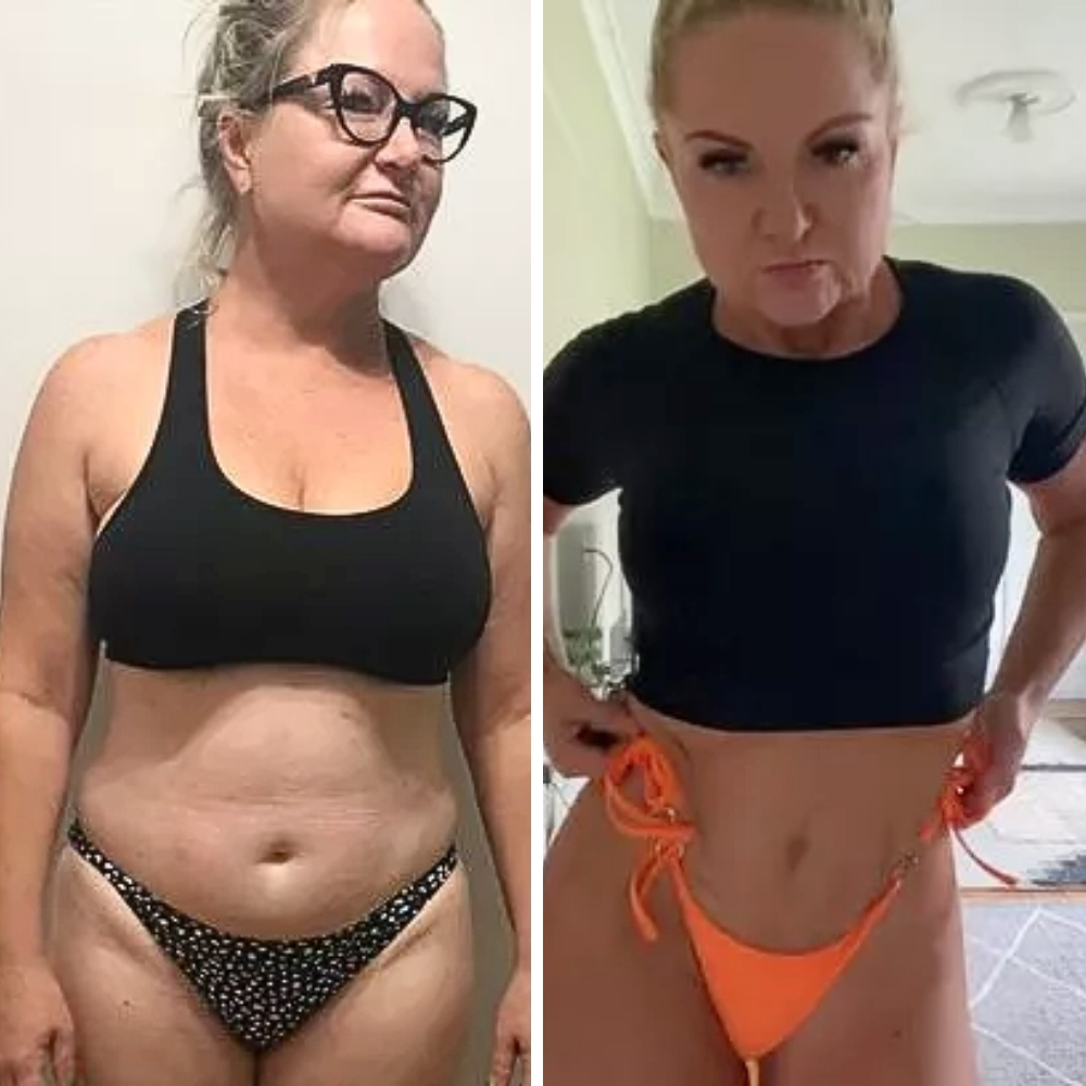 Linda's weight loss transformation