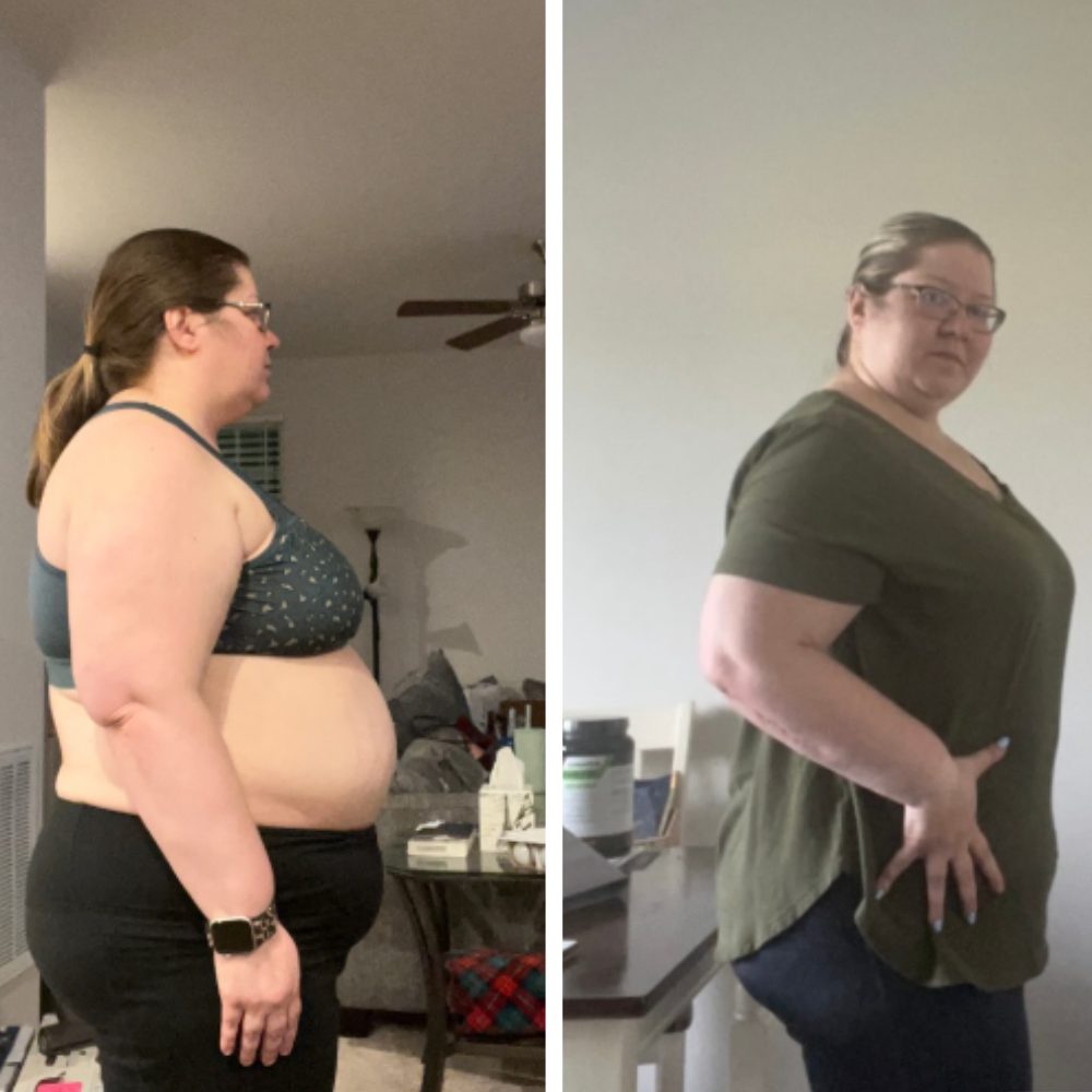 Laura's weight loss transformation